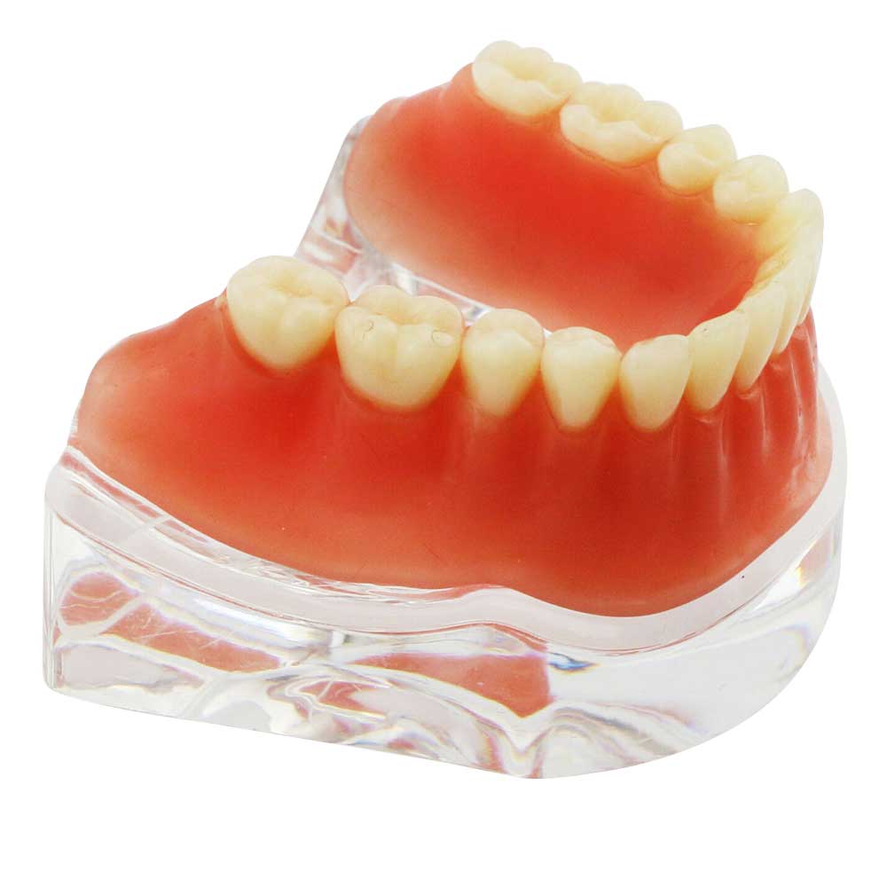 iDENTical Implant Model With Silver Bar M6008