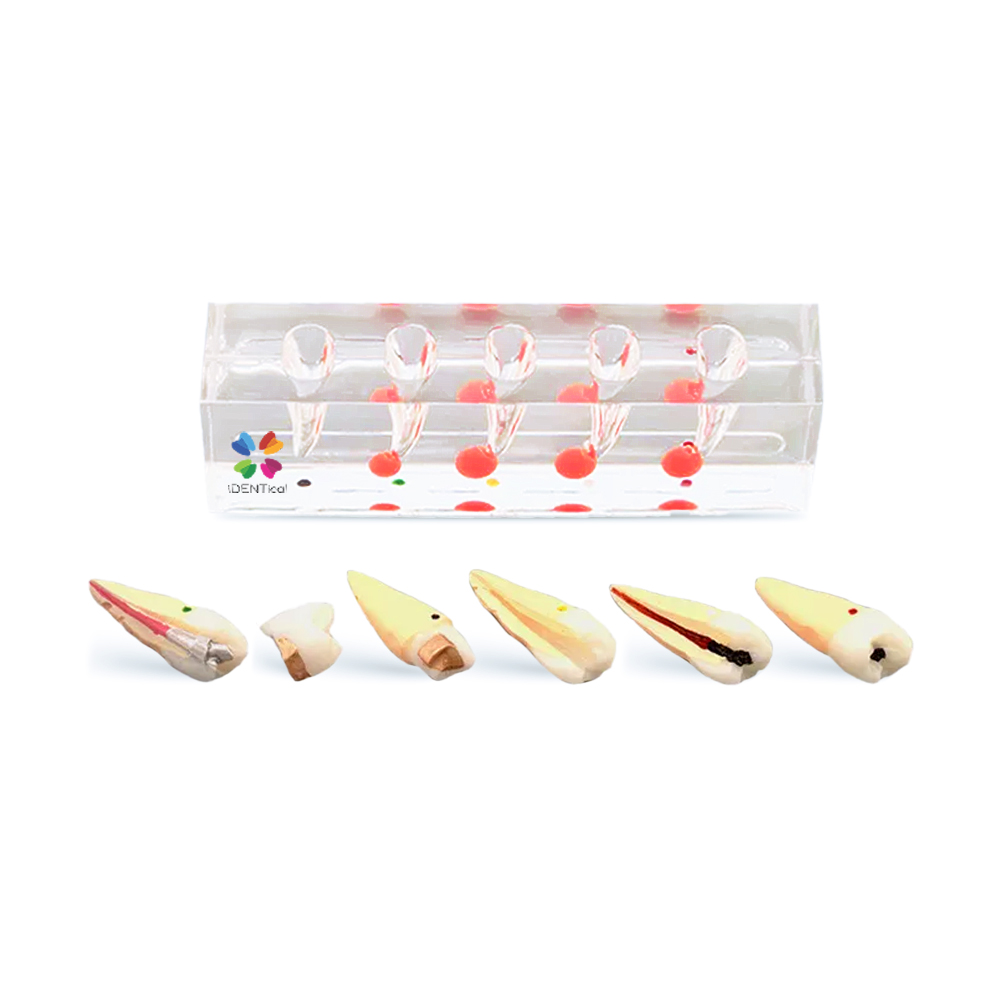 iDENTical Endodontic Treatment Model (M4007-2)