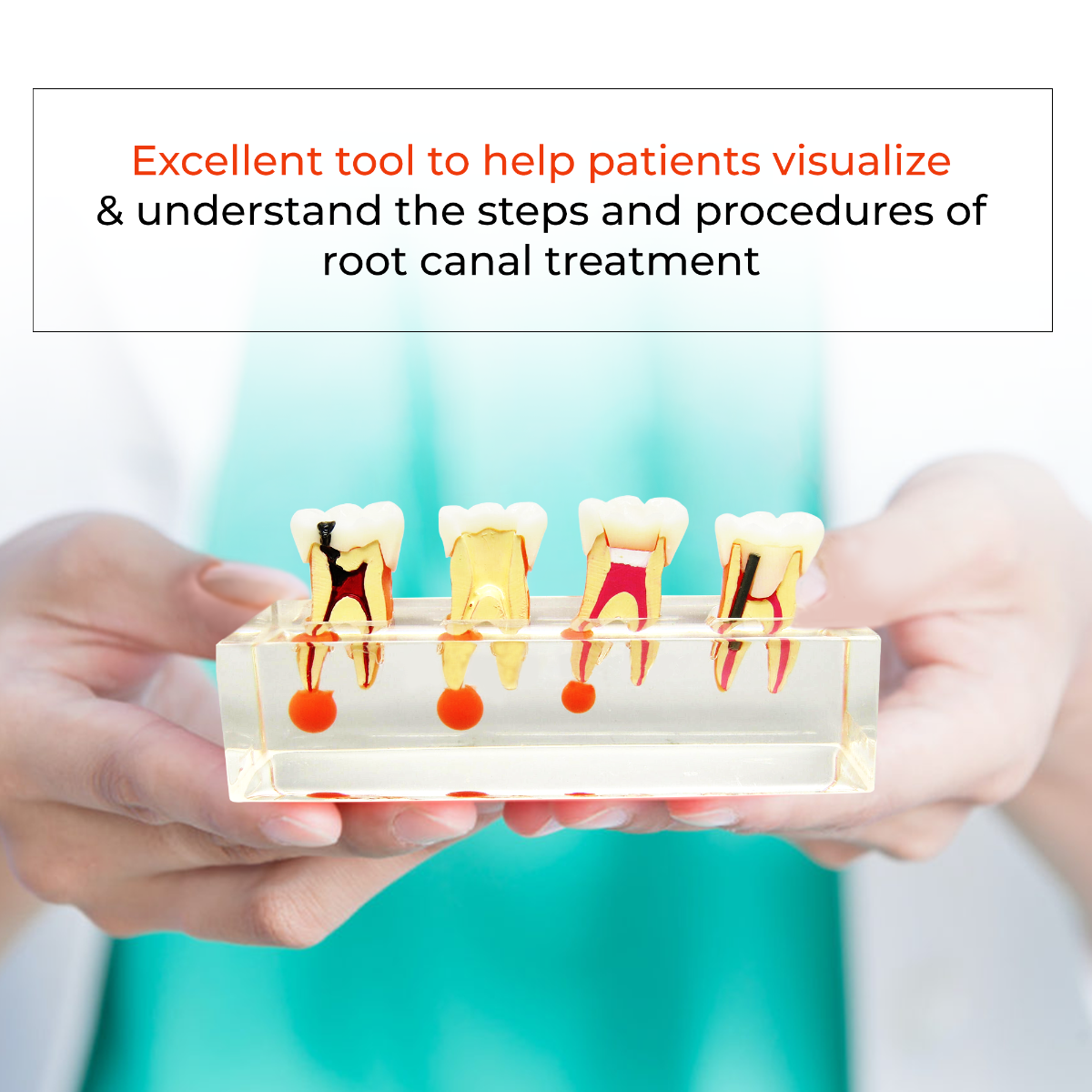 iDENTical Study Model Root Canal Treatment M 4018