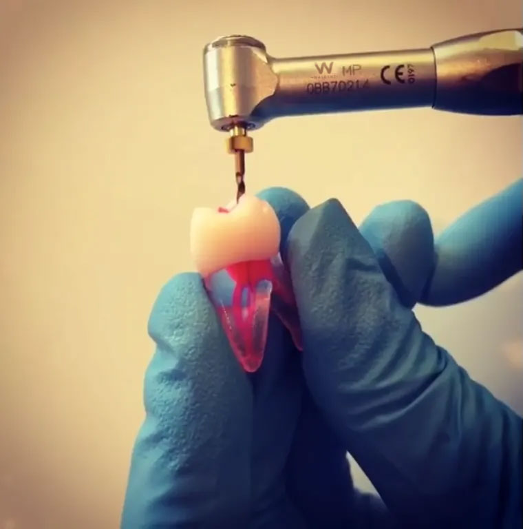 Waldent Premium Taper Gold Rotary Files - 21mm