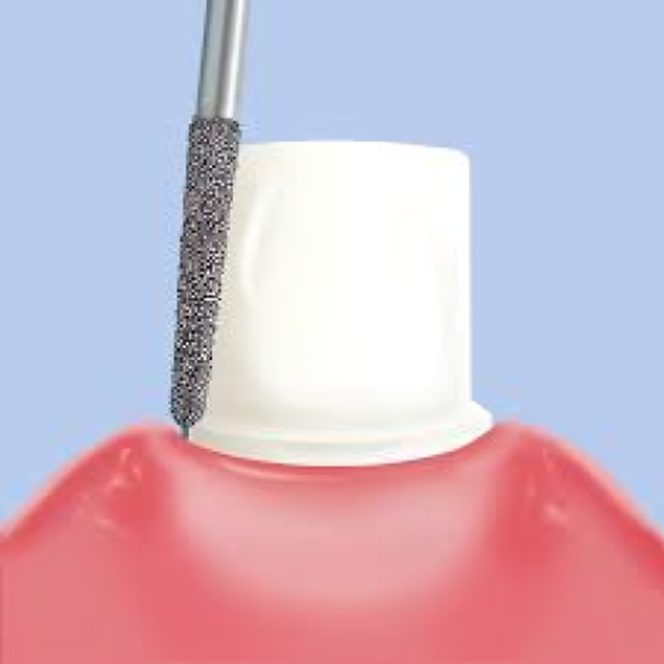 Pivo Straight Ogival End Contra-angle Diamond Burs CA - SO (Pack Of 5)