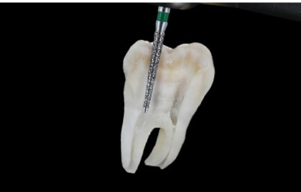 Prima Dental Endodontic Access Kit