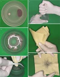 AHL Amalgomer CR Ceramic Reinforced Posterior GI Restorative Material