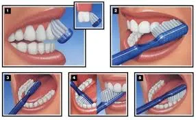 Stim Ortho Brush (Pack Of 12)