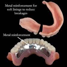 Detax Molloplast B (Powder Only 45gms)