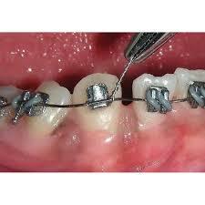 G&H Stainless Steel Ligature Ties Long 1000/pk