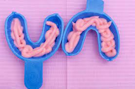 Prevest Denpro Fluorotop APF