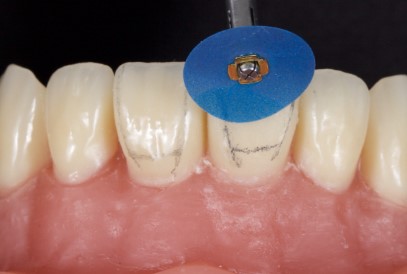 Tor Vm Polishing Discs