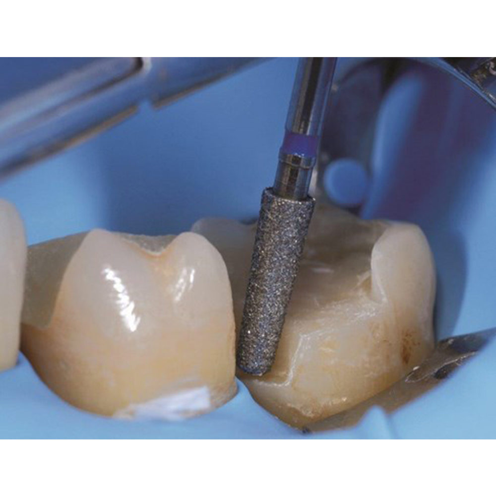 SuperEndo Inlay Preparation Burs Kit