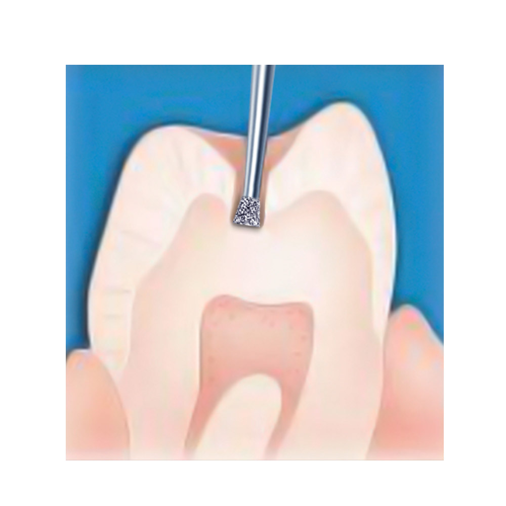 Frank Dental Straight Inverted Cone Diamond Bur FG -SI & DI (Made in Germany)