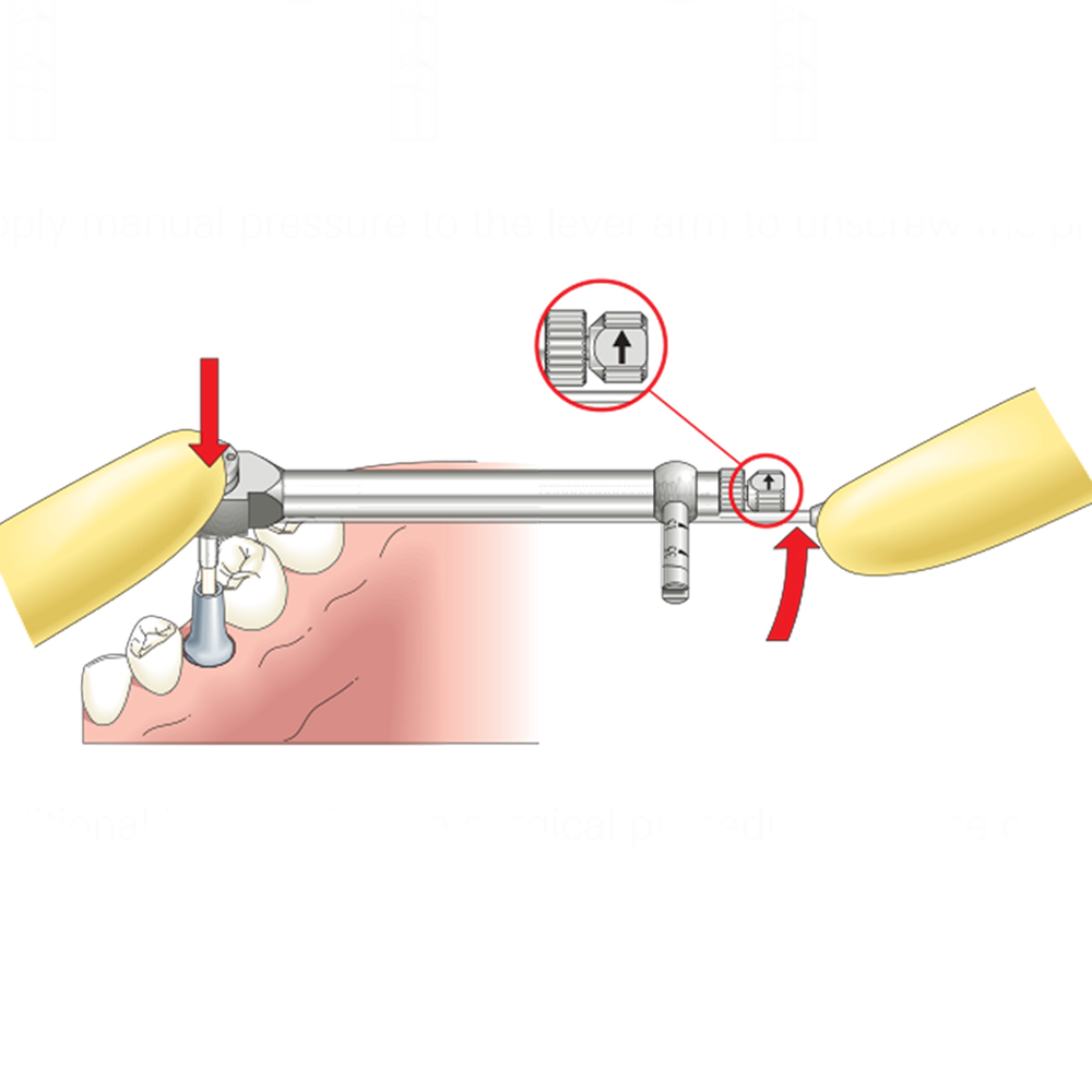 DentalPlant Implant Torque Wrench Ratchet 10–70 Ncm
