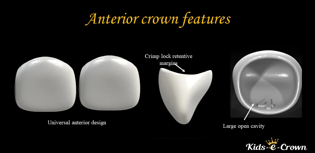 Kids-e-Crown Zirconia Universal Upper Lateral Incisor Refills