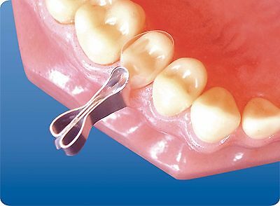 Tor Vm Transparent Contoured Matrices for Premolars & Molars