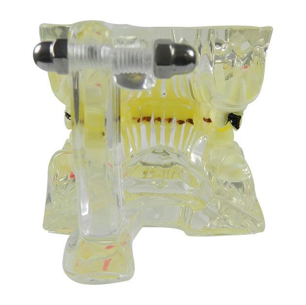 iDENTical Adult Pathologies Model M4001-2