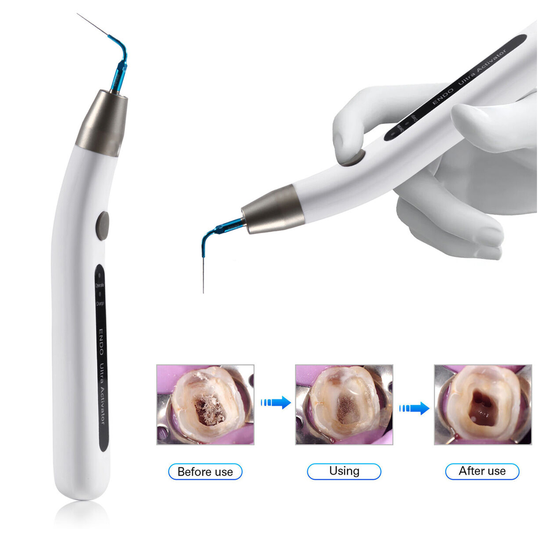 Dontics Endo Ultrasonic Activator With LED