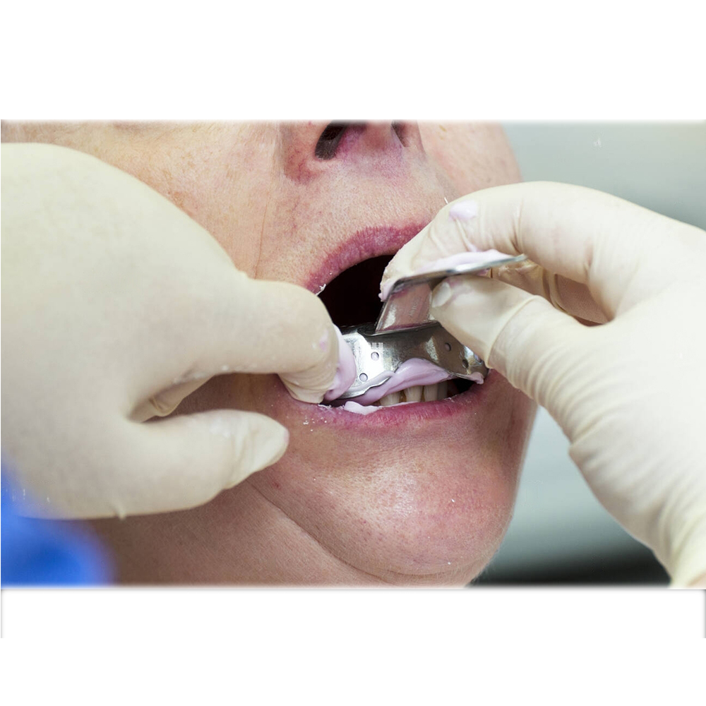 GDC Dentulous Perforated Impression Trays Lower # 4 (ITRLDPL4)