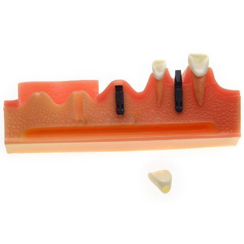 iDENTical Steps for Implant Model M2018