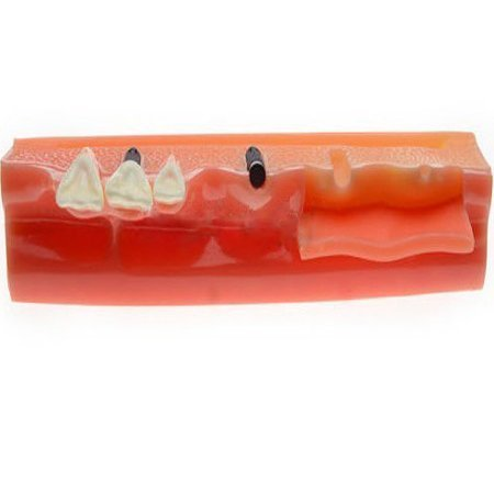 iDENTical Steps for Implant Model M2018