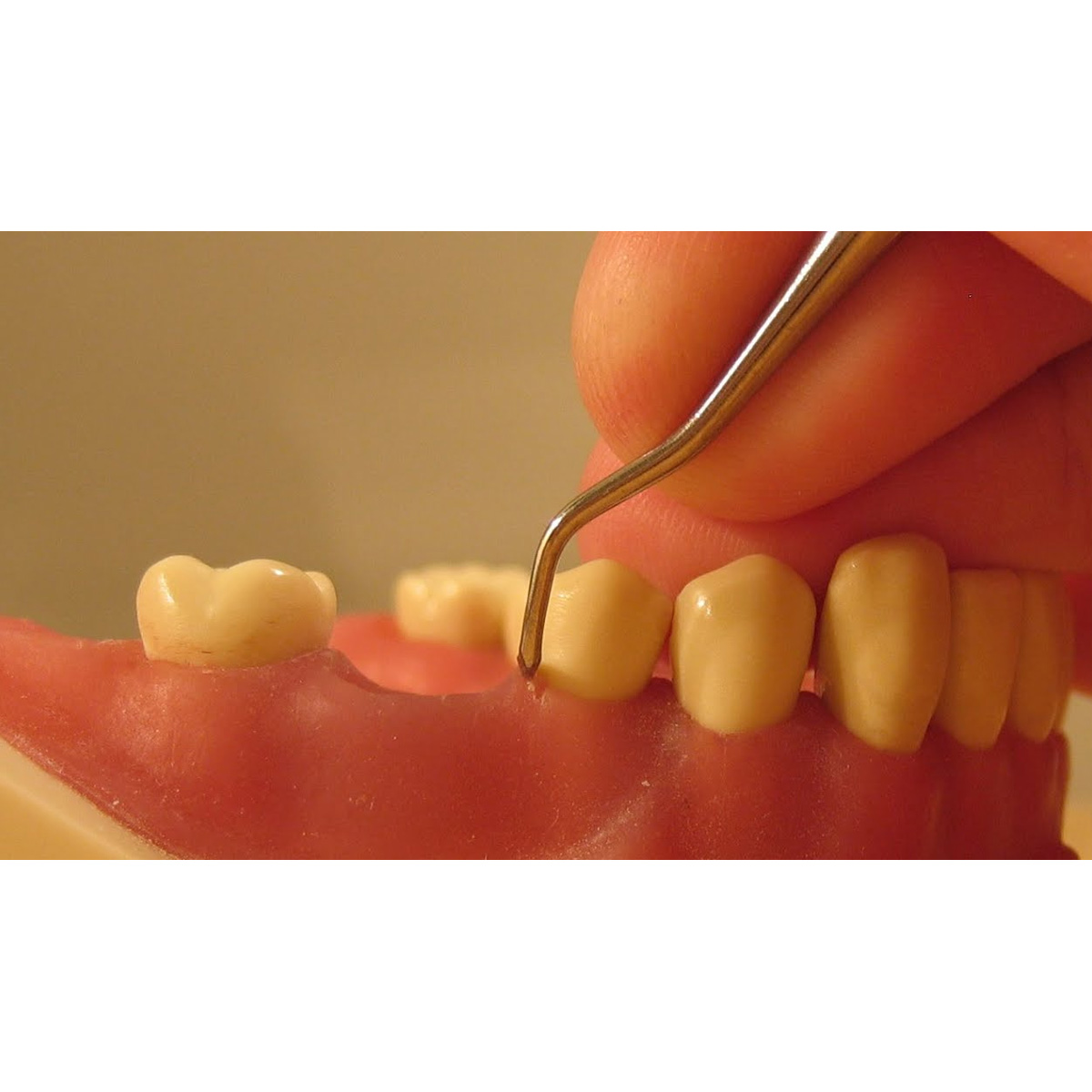 American Eagle Universal Blackjack Scalers With XP Technology