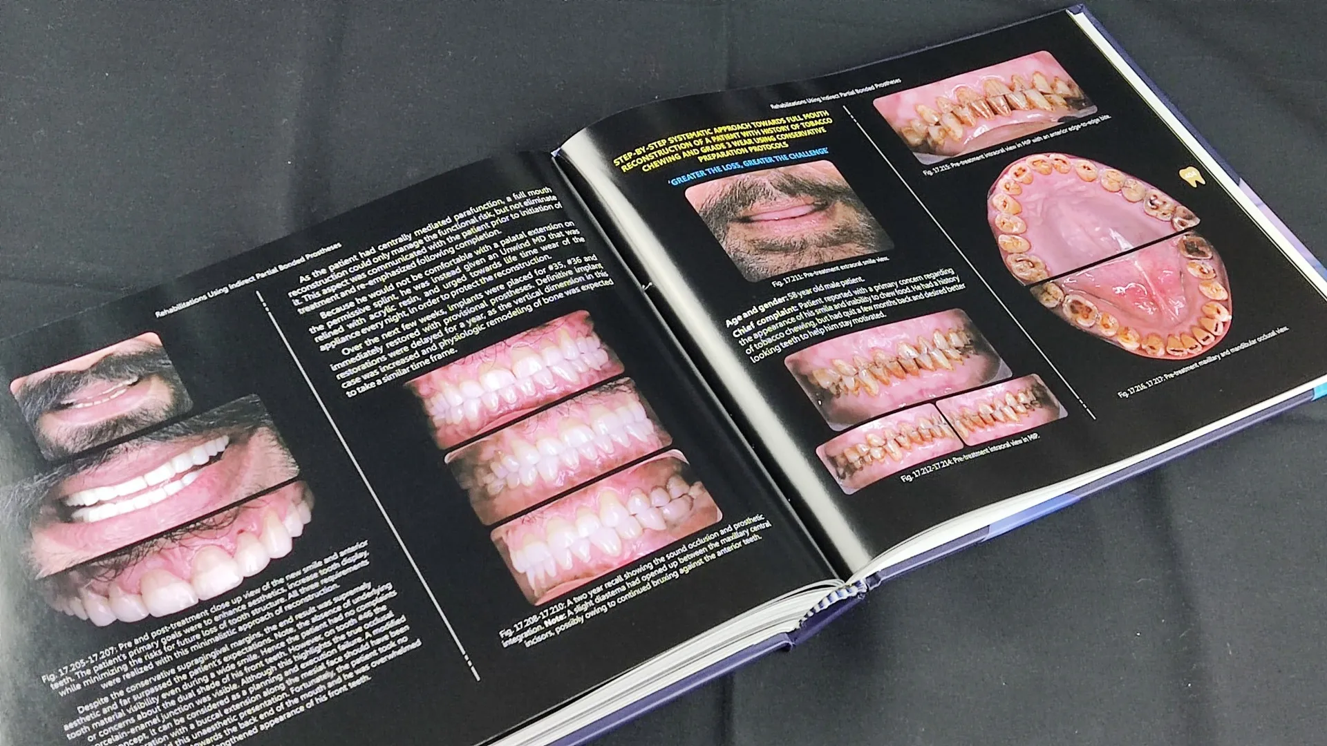 Mik Clinical Fixed Prosthodontics- 2nd