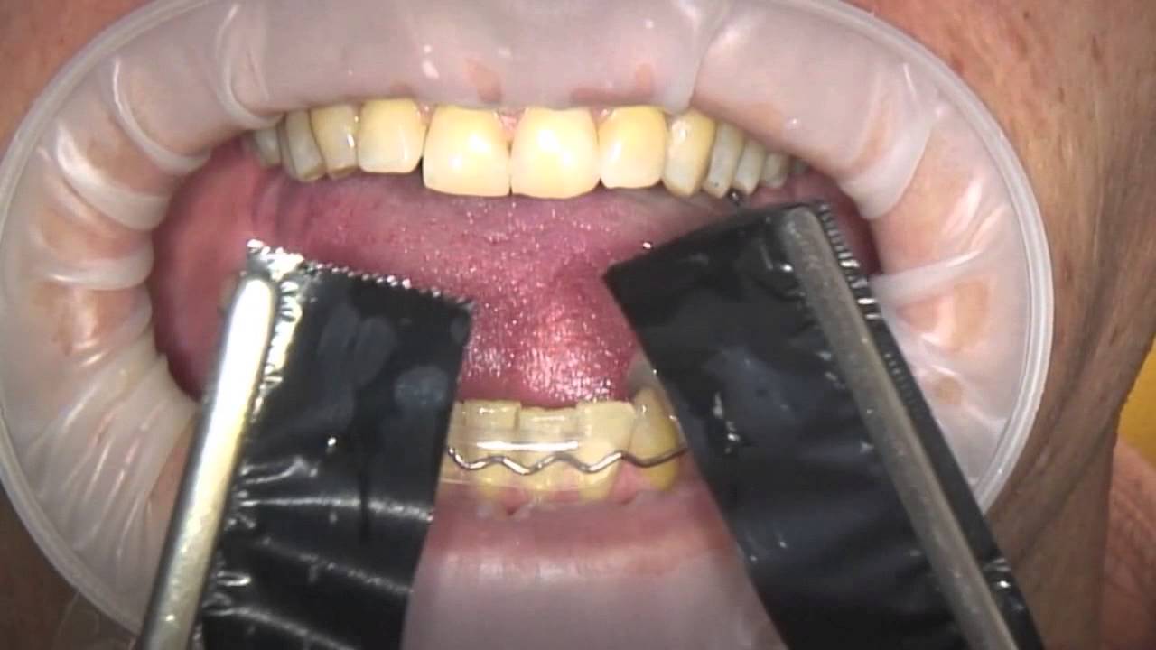 Bausch Dental Arti Fol Metallic Shimstock Flim 12µ Microns