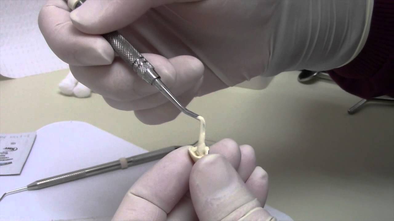 Prime Dental Templute Temporary Luting Cement