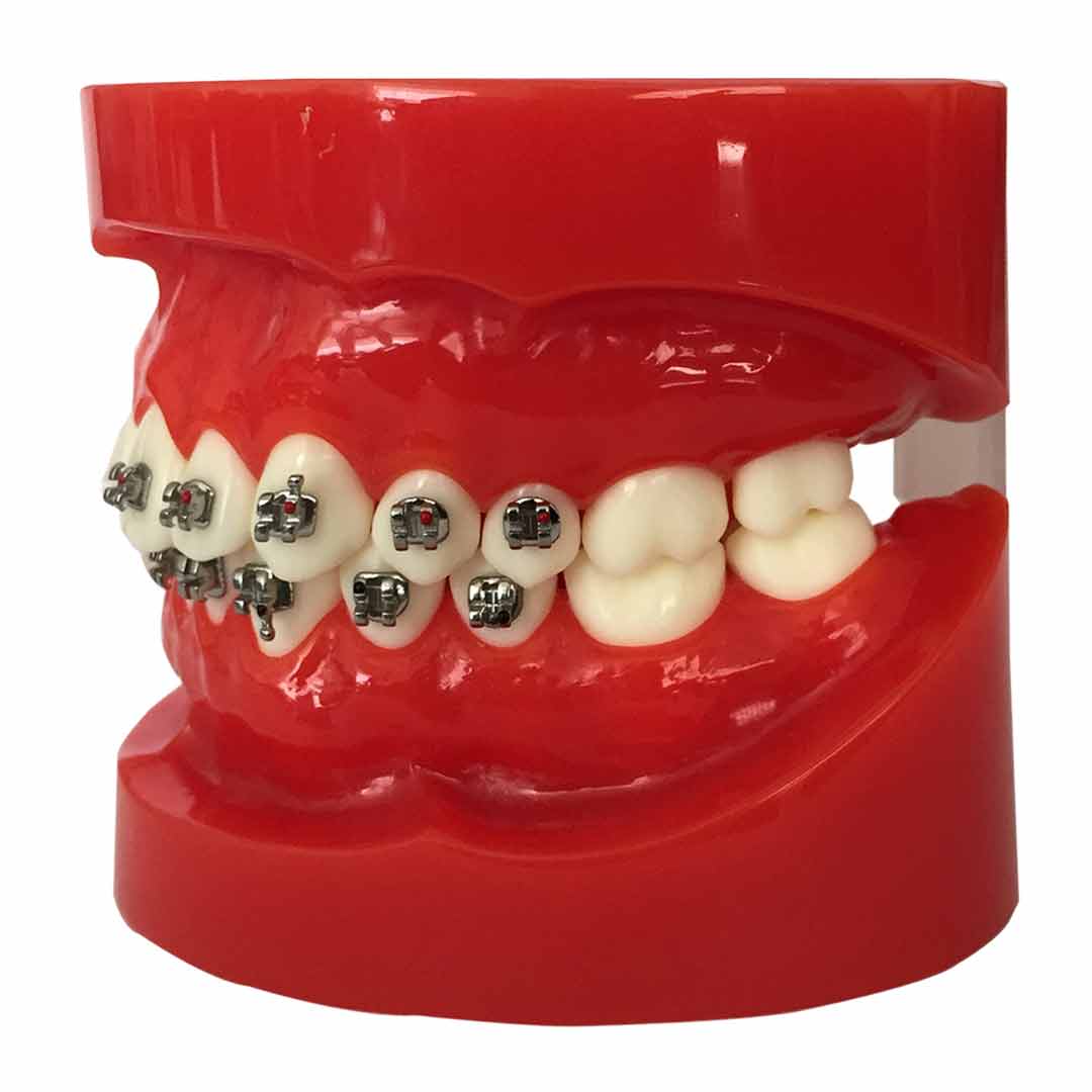 iDENTical Half Metal and Half Ceramic Brackets Orthodontic Models M3003