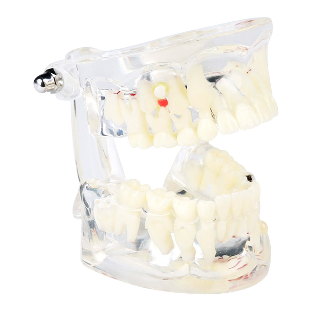 IDENTical Paediatric Model with Pathologies M4002 