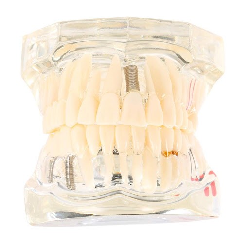 iDENTical All In One Implant Models M2001