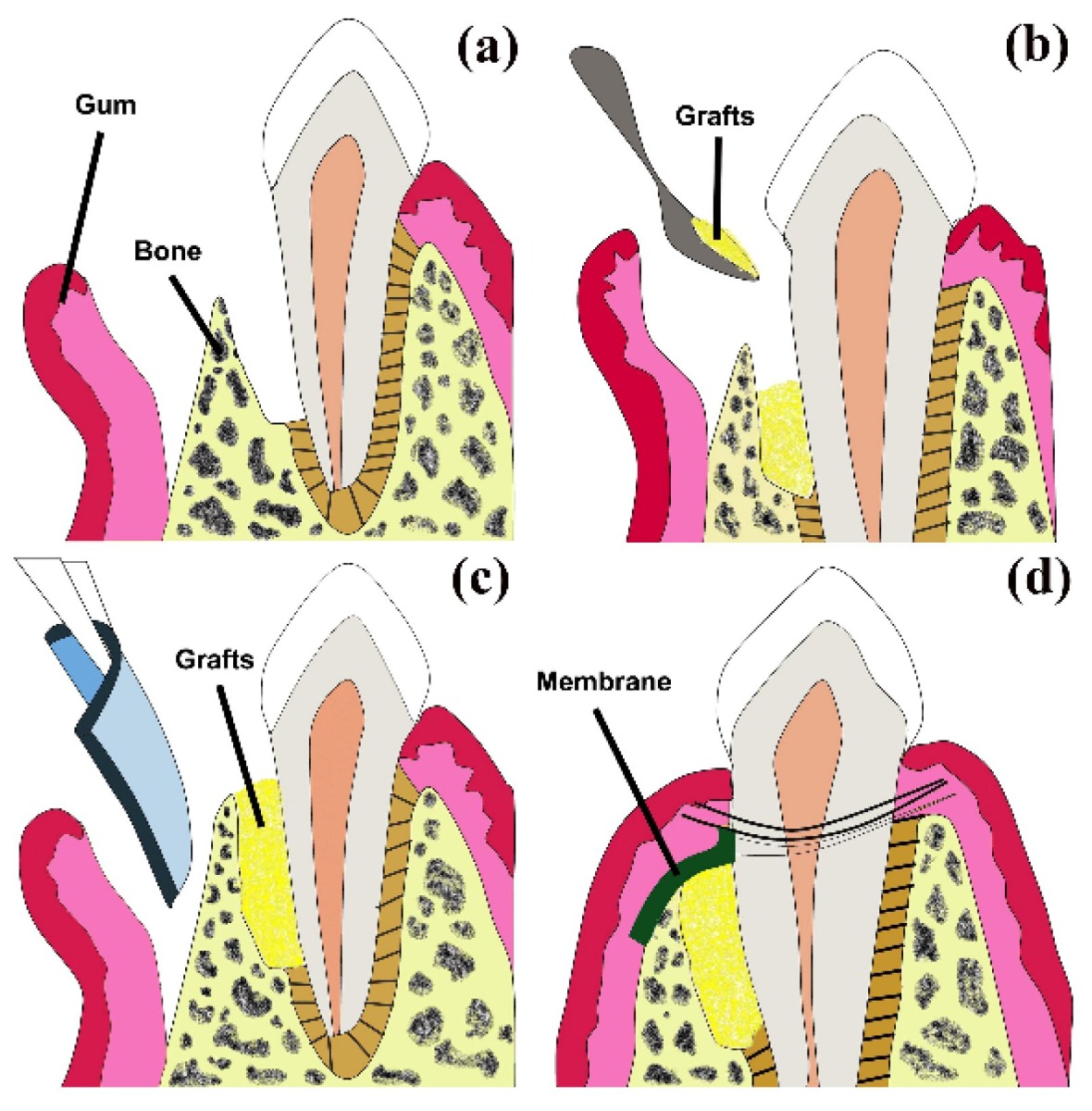 Advanced Biotech Healiguide