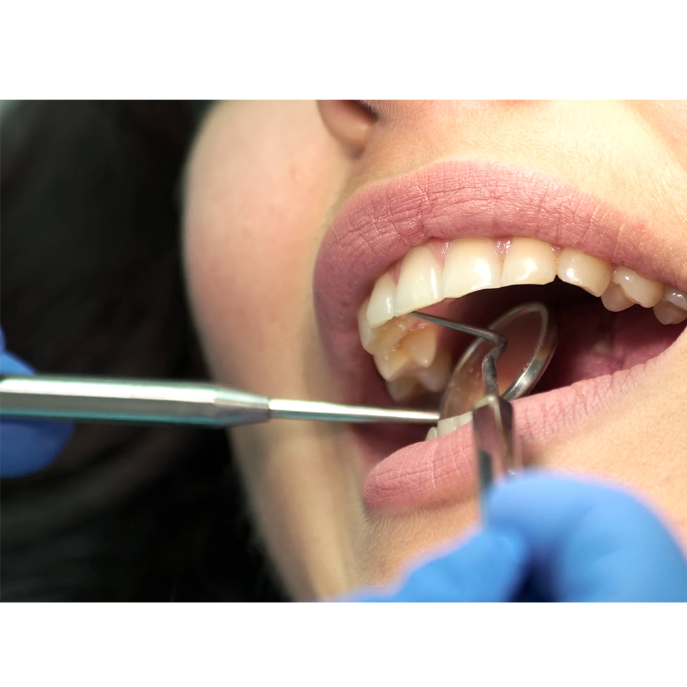 GDC Mouth Mirror Handle #2 (MH2)