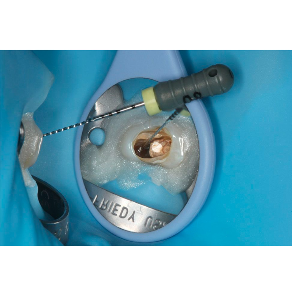 Hahnenkratt Relax Fs Rhodium Mouth Mirror #5 Set