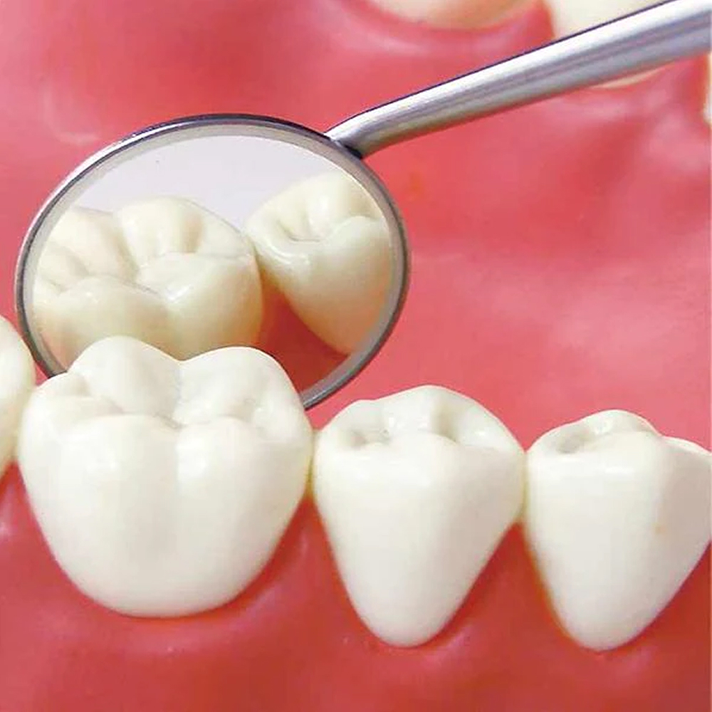 GDC Mouth Mirror Tops Fs Rhodium Coated Pack Of 12 Pcs - 4 (Mmtfs4)