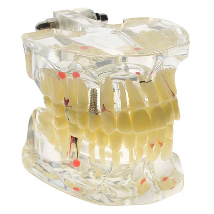 iDENTical Adult Pathologies Model M4001-1