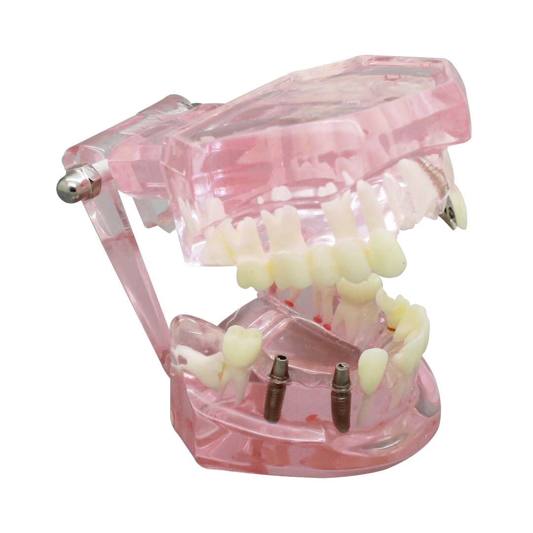 iDENTical All In One Implant Models M2001