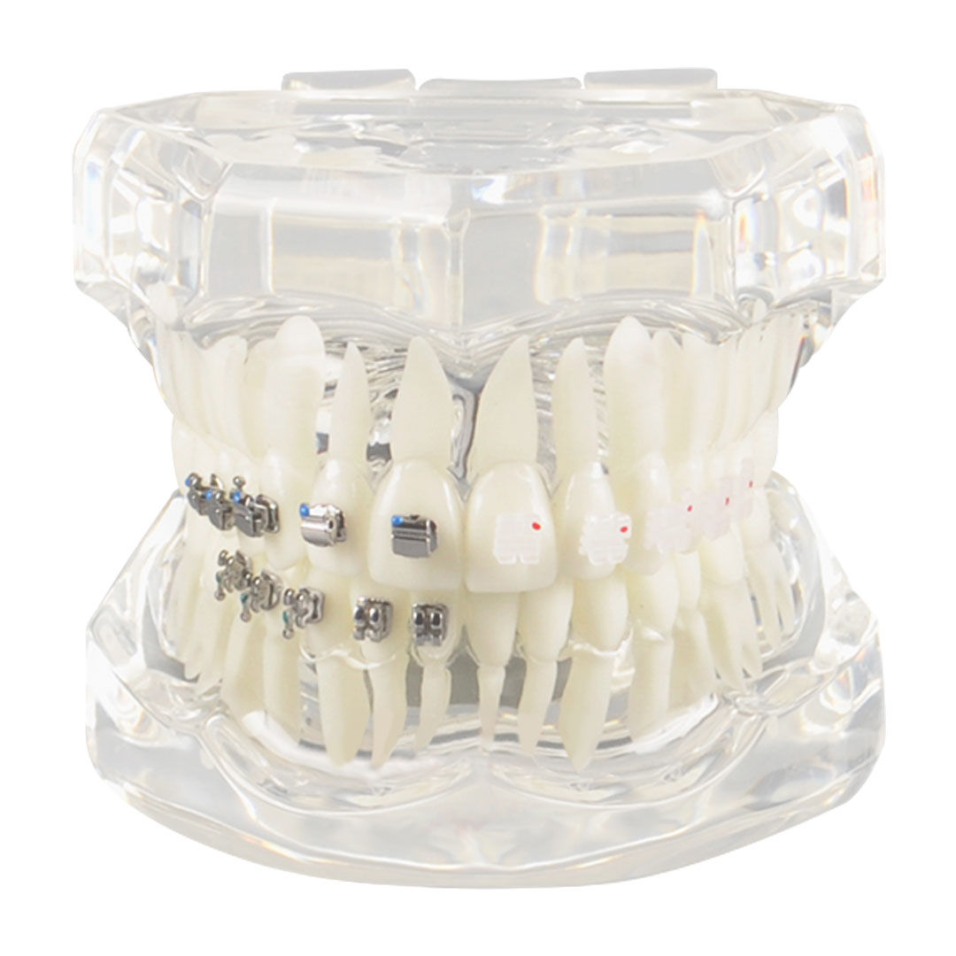 iDENTical Self Ligating Model M3012 White