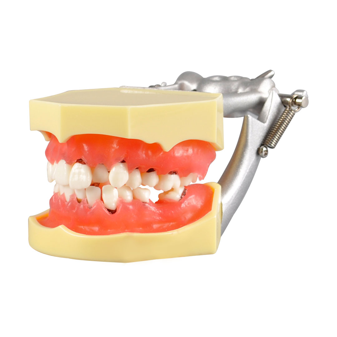 iDENTical Periodontal Model M4003