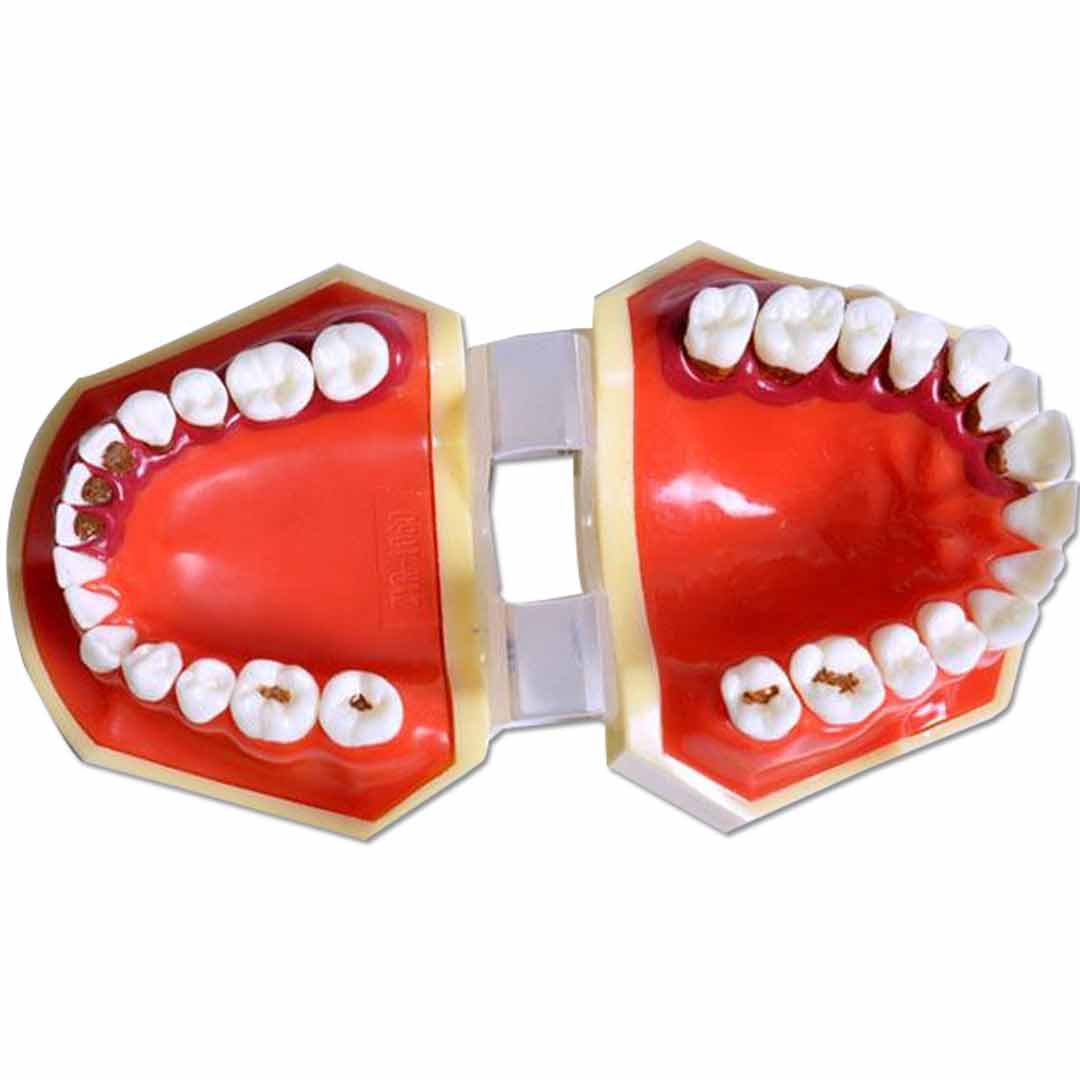 iDENTical Periodontal Disease Model M4025