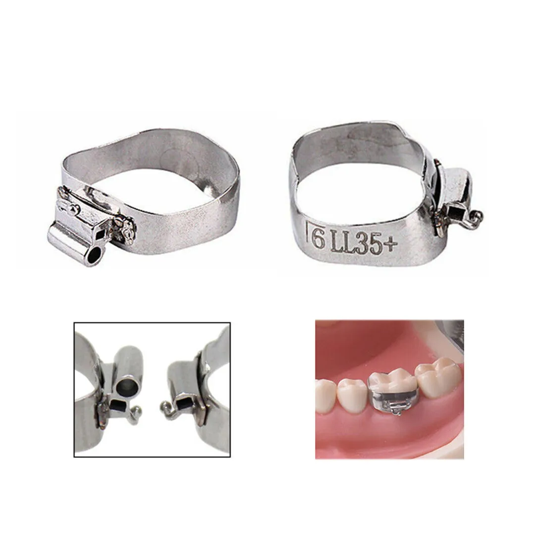 OSL 1st Molar Prewelded Molar Bands MBT 0.022 U2/L1 (Pack Of 4)