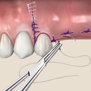 Dental Suture Practice Kit - Type I