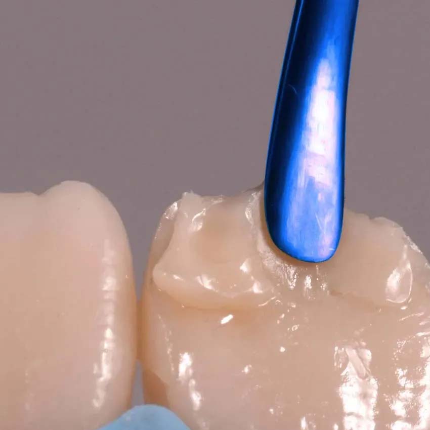 Prime Dental Restorite Nano Hybrid Composite