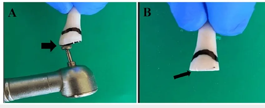 NewDiamond Diamond Bur WH-13 (Pack Of 3)