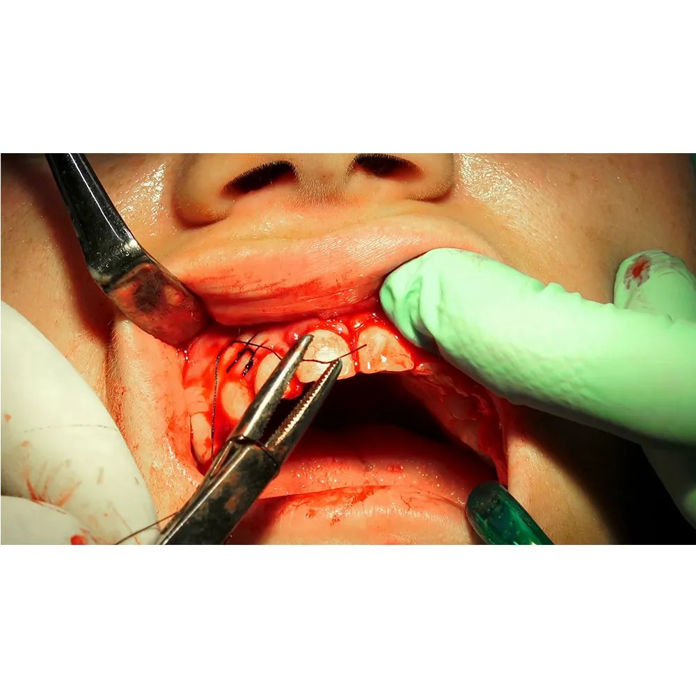 Oracraft Halsey Tc Needle Holder (NH5037)