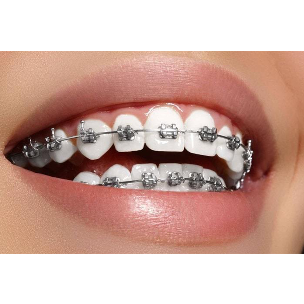 Prime Ortho NiTi Archwires Natural / Pro Form - Round (25/Pk)