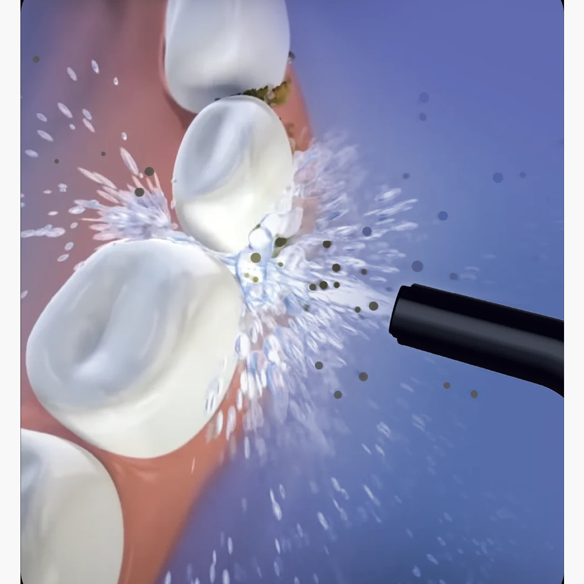 Oracura OC450 Dental PRO Countertop Smart Water Flosser