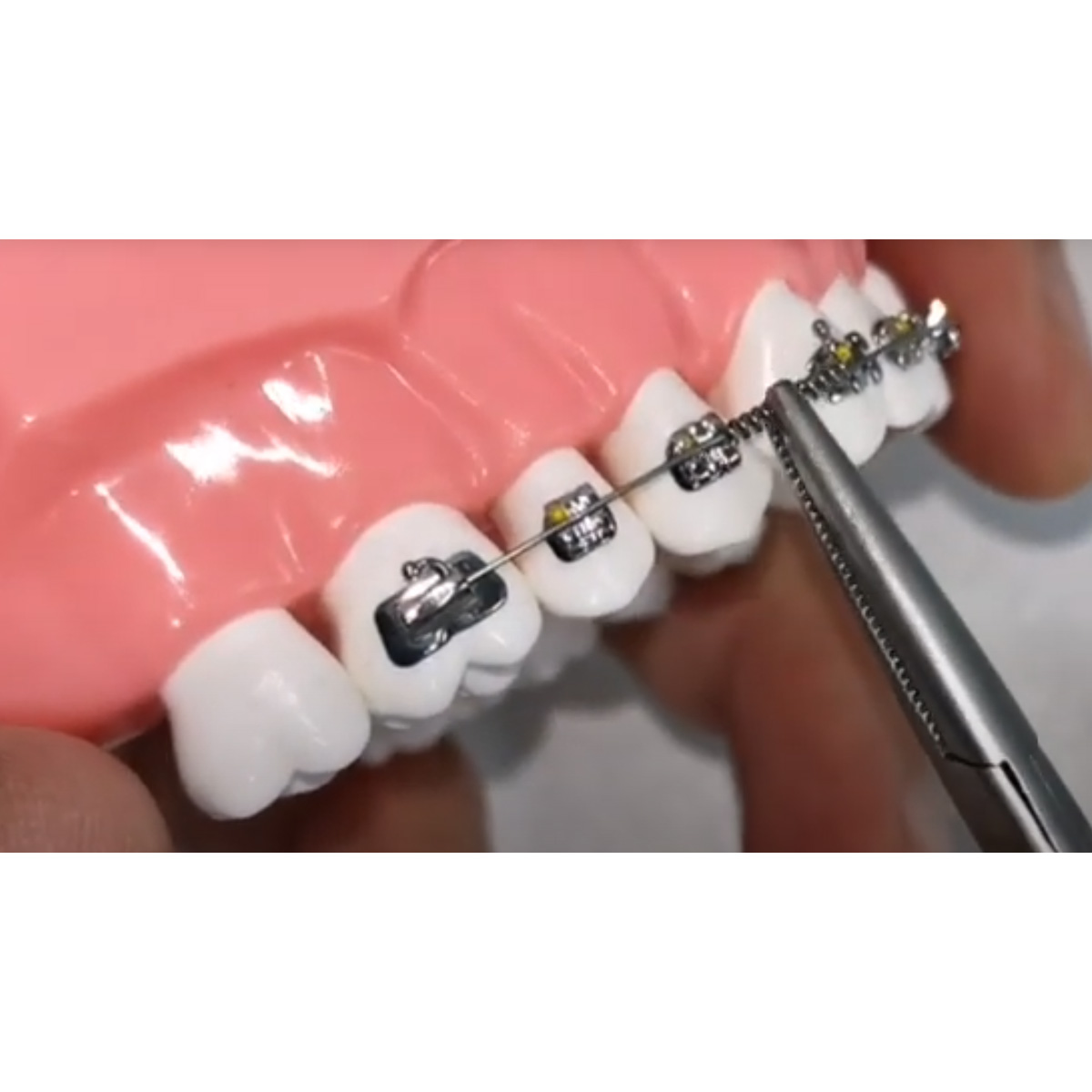 JJ Ortho NiTi Open Coil Spring 180mm (60.01.17)