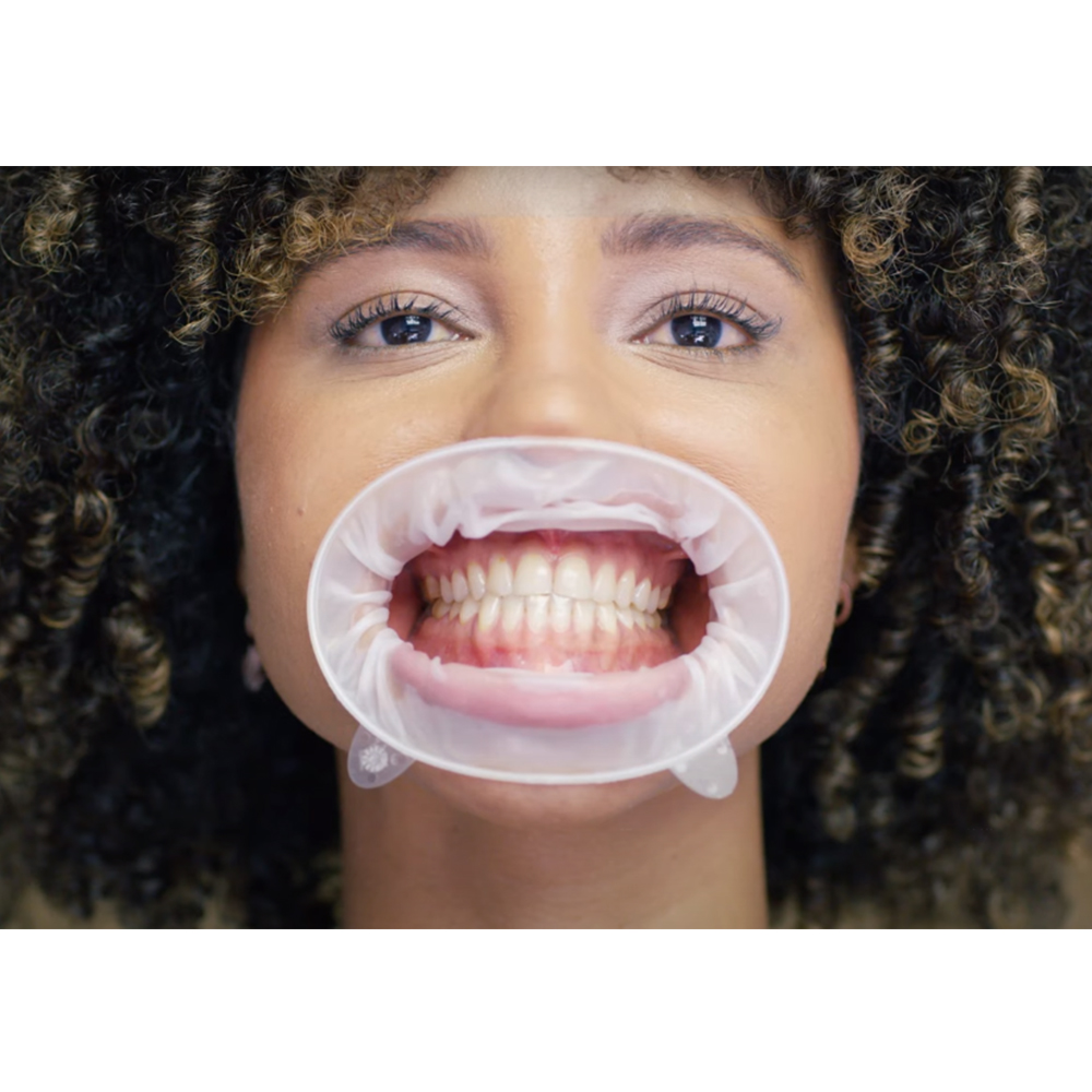 Ivoclar Optragate Regular (Pack Of 1)