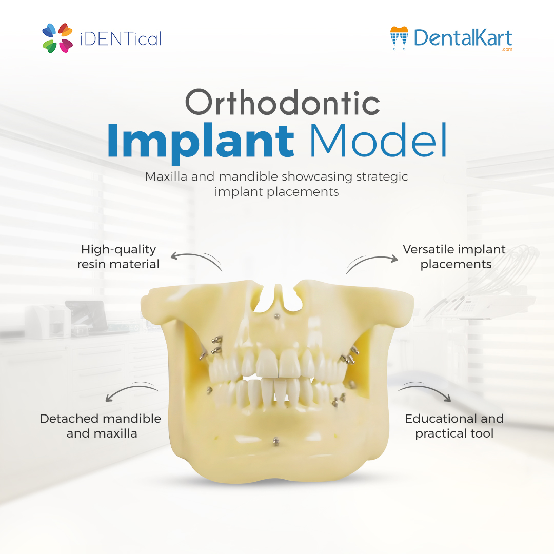 Buy iDENTical M2016 Orthodontic Implant Model : Maxilla & Mandible