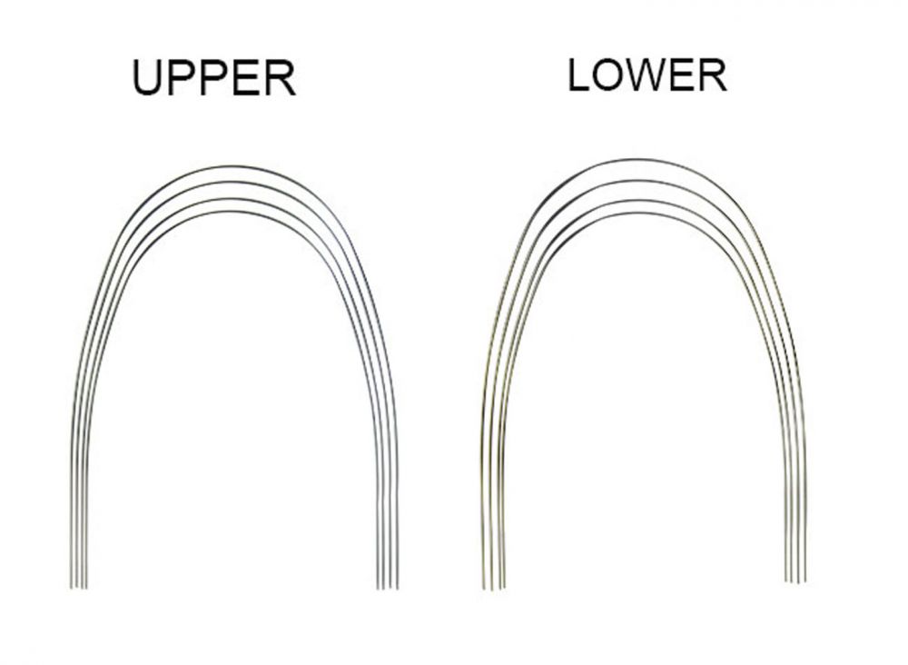 Phyx Preformed SS Archwire Round (Pk of 10)