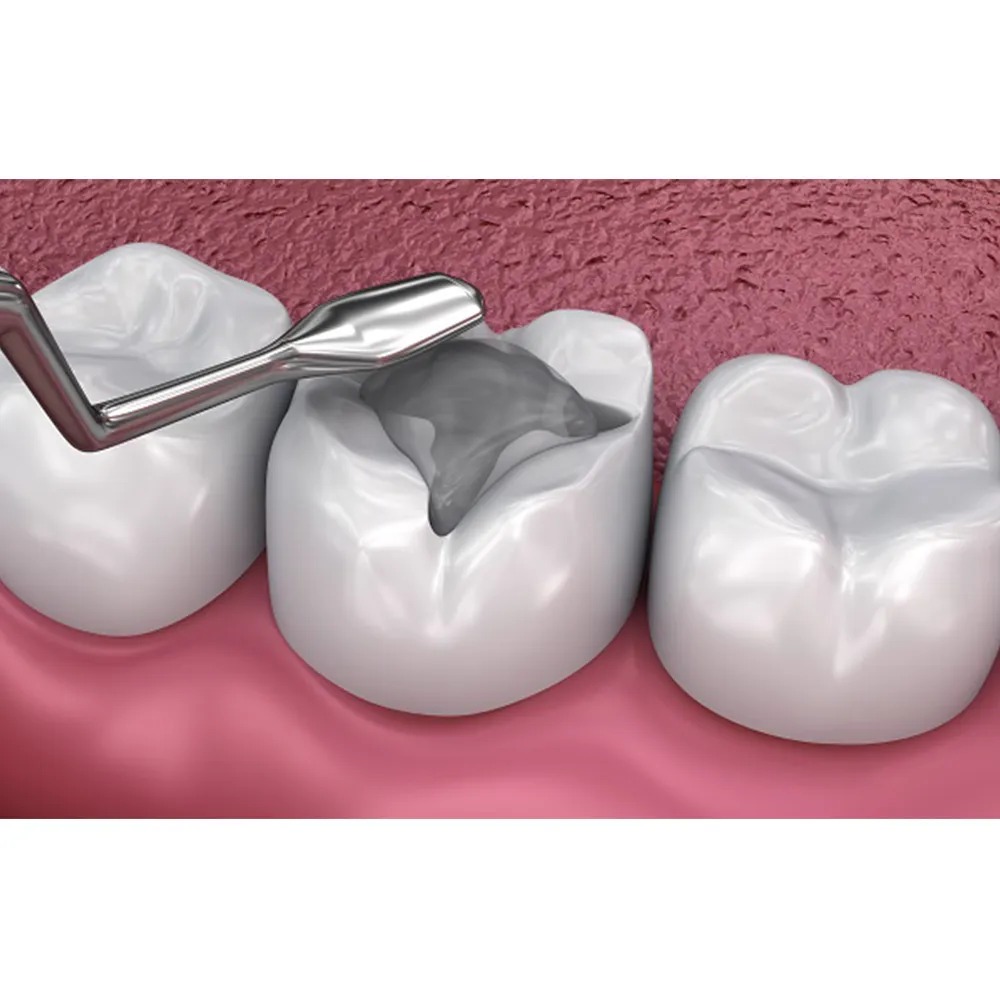 GI Dental Parallelogram Condenser